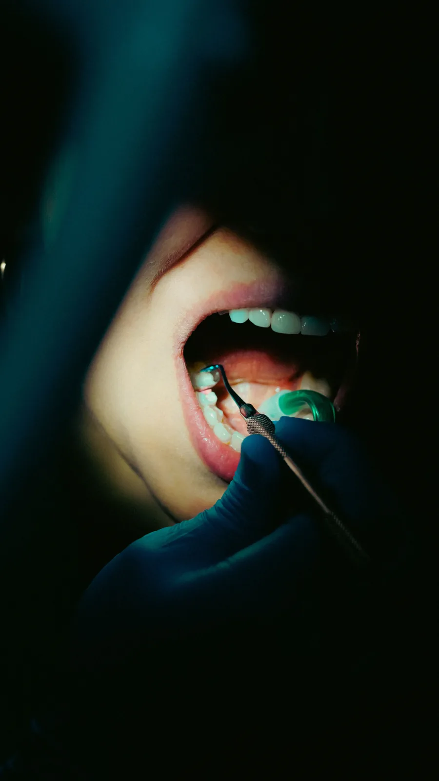 Dentist examining a patient's teeth with a dental probe during a check-up