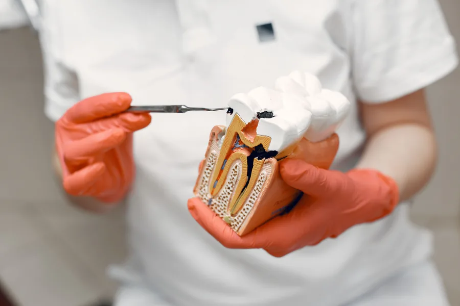 Cross-section model of a tooth used to explain root canal treatment